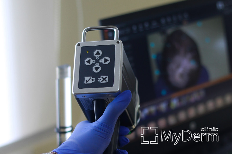 Цифровая трихоскопия в клинике MyDerm, город Киев