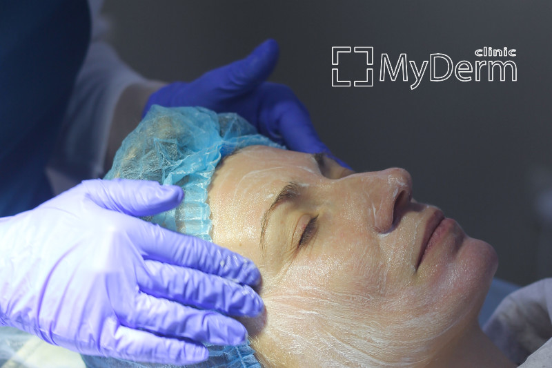 Пілінги в MyDerm