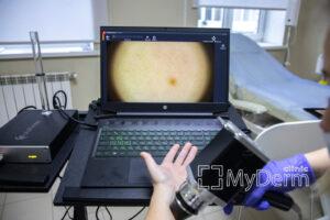 myderm-picture-10-1