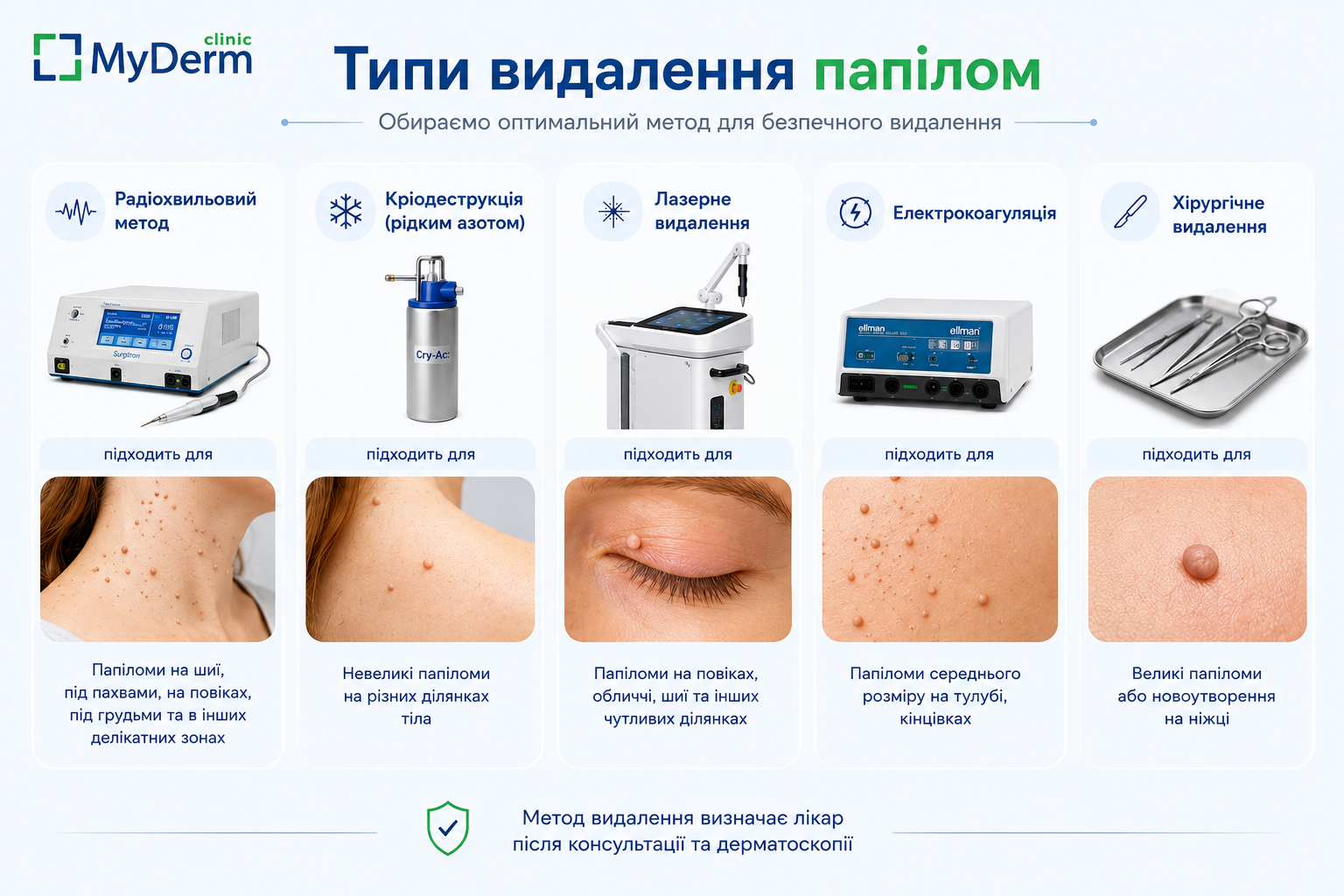 типи видалення новоутворень