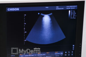 УЗД-діагностика в MyDerm, місто Київ